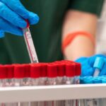 cheap Pathology tests in kolkata