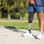 prosthetics and orthotics